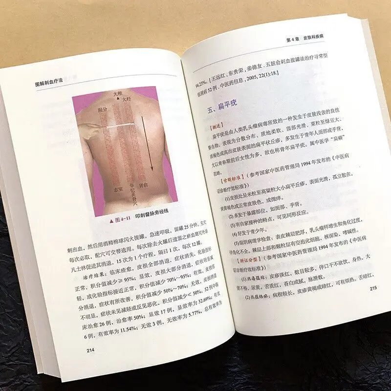 Bloodletting Therapy Explained - Therapy Health And Wellness 评论和价格